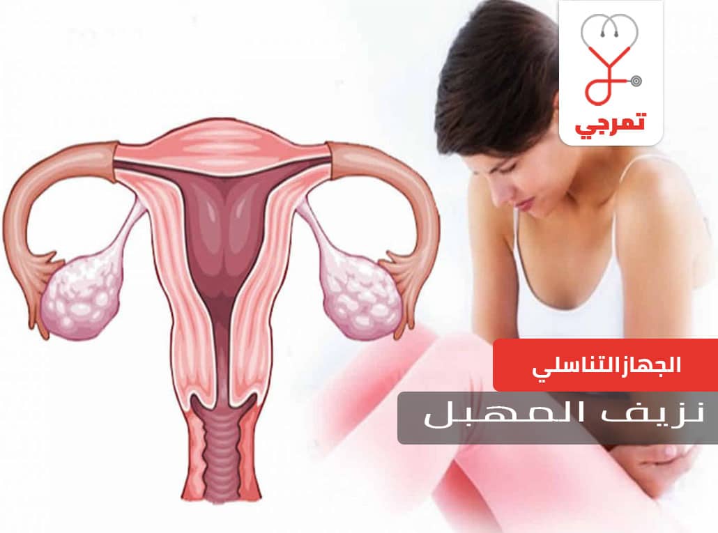 نزيف المهبل