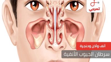 أنف وأذن وحنجرة Archives | تمرجي