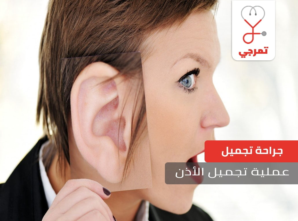 تجميل الاذن
