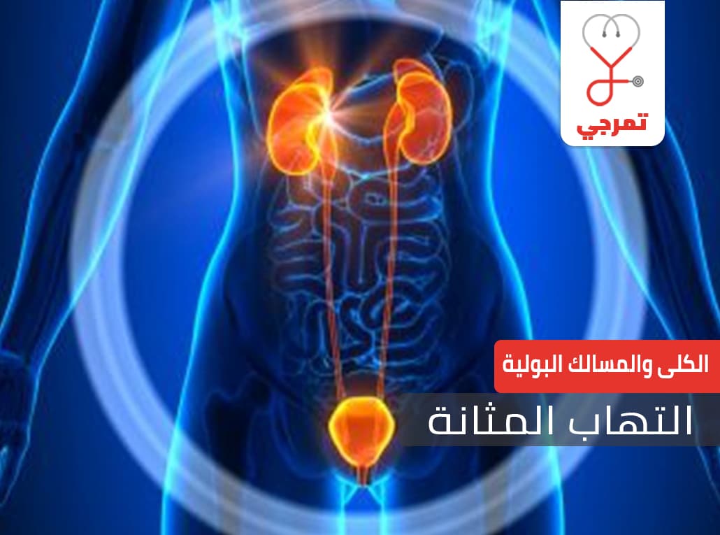 اعراض التهاب المثانة عند النساء