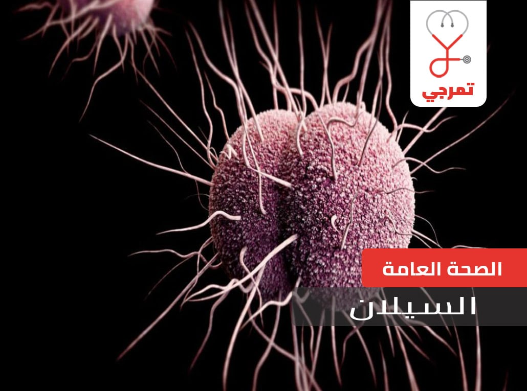 السيلان