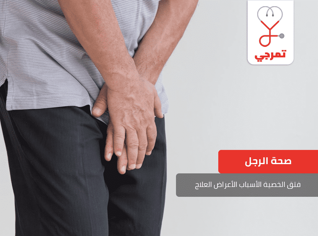 فتق الخصية