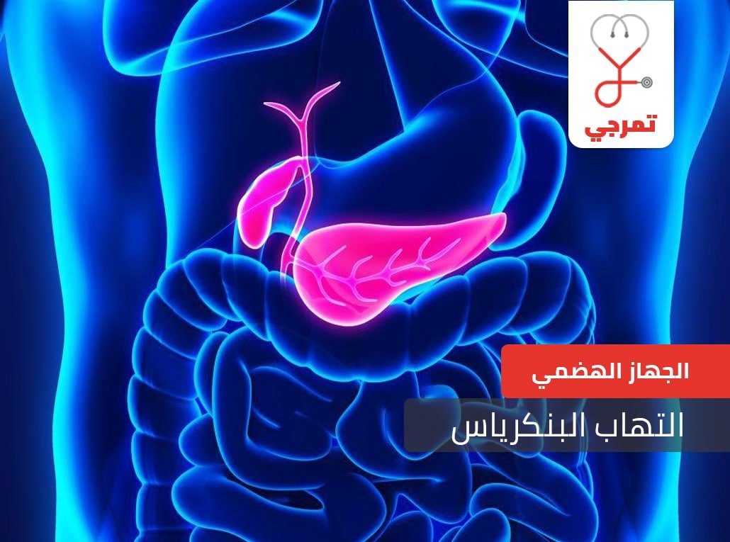 التهاب البنكرياس