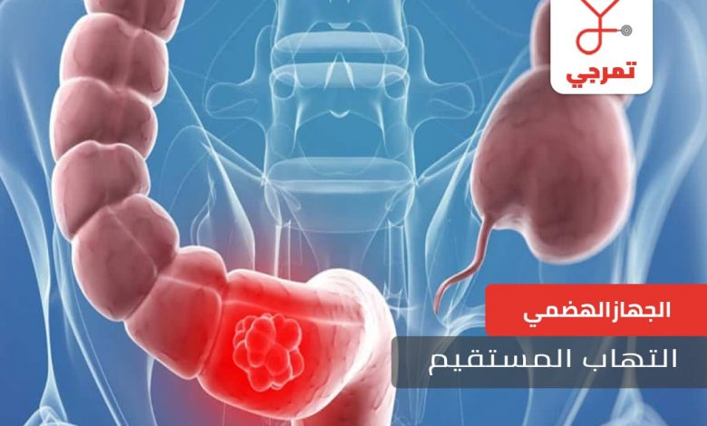التهاب-المستقيم