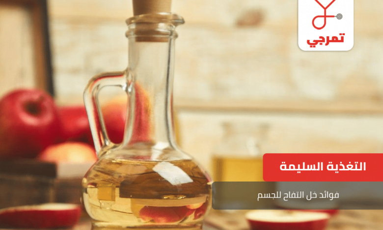 خل التفاح