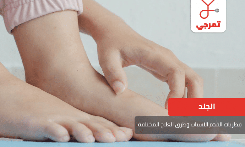 فطريات القدم الأسباب وطرق العلاج المختلفة تمرجي