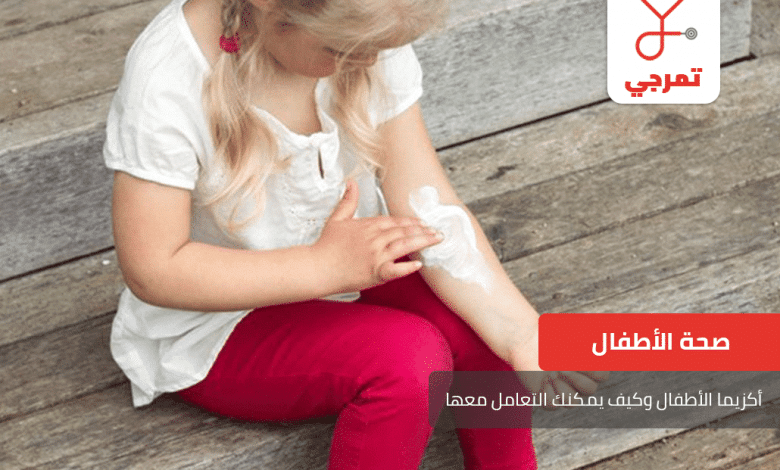 أكزيما الأطفال