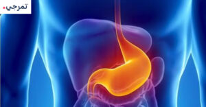 إيزوميبرازول