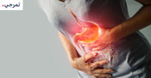 إيزوميبرازول