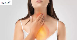 علاج أوميبرازول